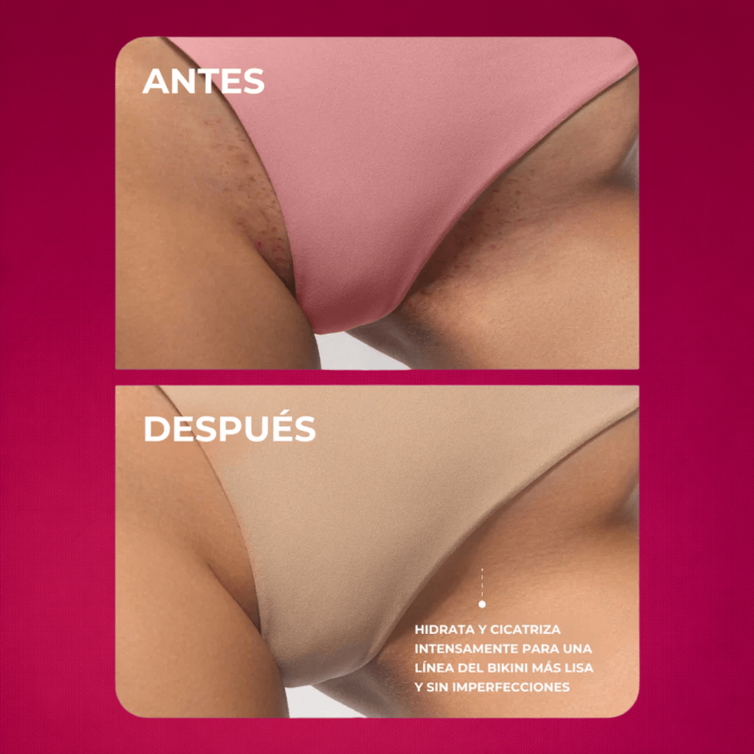 Aceite Truly Para Piel Perfecta - Lisa, Clara y Libre de Olores I ORIGINAL