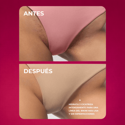 Aceite Truly Para Piel Perfecta - Lisa, Clara y Libre de Olores I ORIGINAL